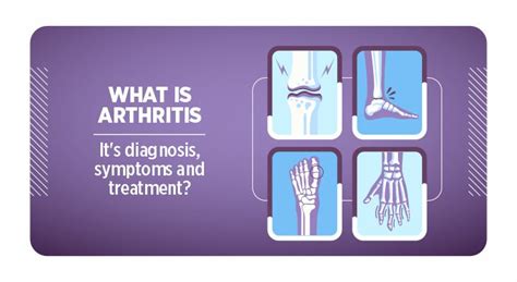 Arthritis; Diagnosis, Symptoms, & Treatment | Accord Hospital