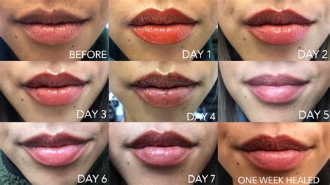 Top 72+ lip tattoo before and after best - in.cdgdbentre