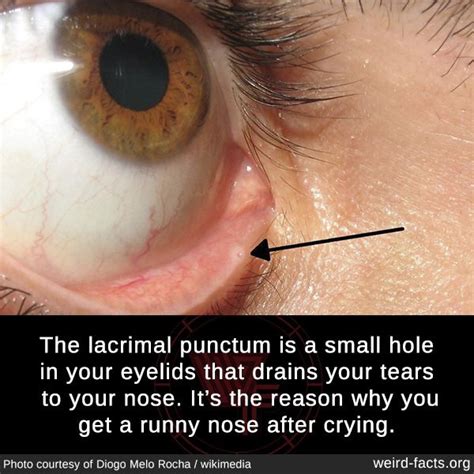 The lacrimal punctum is a small hole in your eyelids that drains your tears to your nose. It’s ...