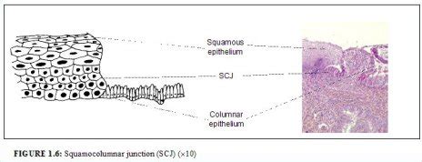 Colposcopy and treatment of cervical intraepithelial neoplasia: a beginners’ manual