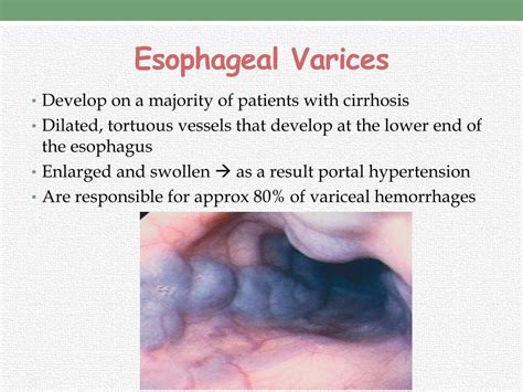 PPT - HEPATIC DISORDERS PowerPoint Presentation, free download - ID:2405873