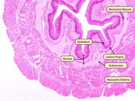 The muscularis externa of the esophagus is unique in that it transitions from striated to smooth ...