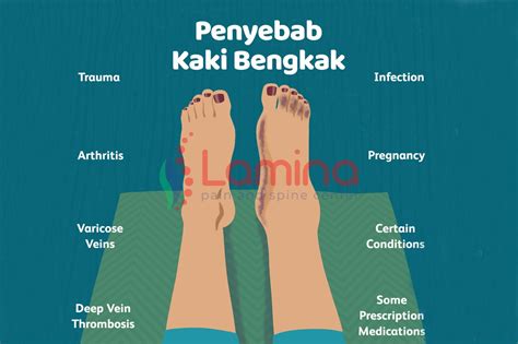 Kaki Bengkak Kenali Gejala dan Penyebabnya » Klinik Patella