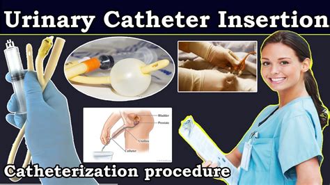 Urinary Catheter Insertion | Catheterization procedure nurses | How to ...