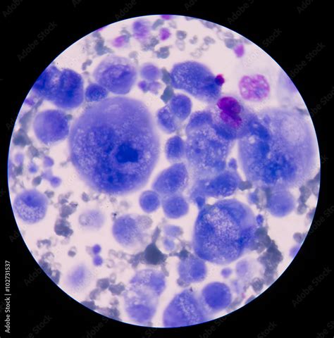 mesothelial cells in body fluid. Stock Photo | Adobe Stock