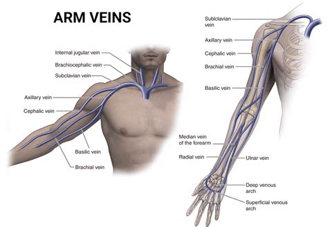 Arm Veins Treatment in NYC & NJ | Vein Care Center