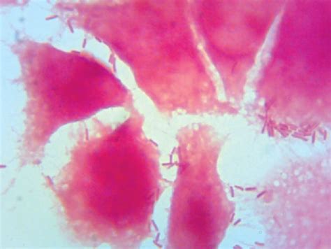 Salmonella Enteritidis adhesion to Caco-2 cells. Optical microscope ...