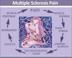 Multiple Sclerosis and Pain – What available treatment options and how ...