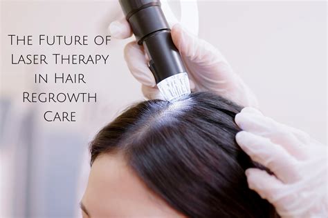 Tackling Hair Loss by Using Lasers for Hair Regrowth - Kiwla