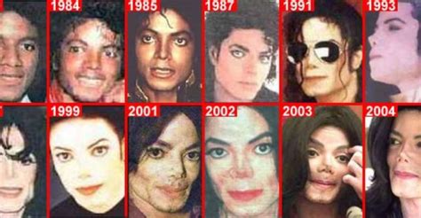 Heartbreaking Testimony: This Is How Michael Jackson's Skin Color ...