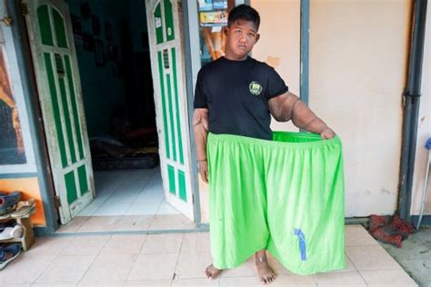 Fattest kid in the world loses nearly 16st – almost half his body ...