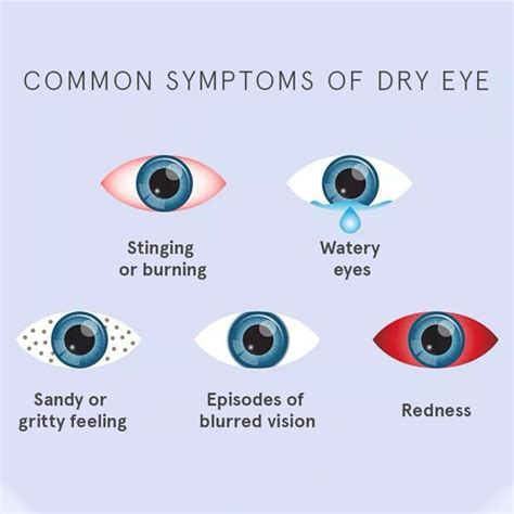 Dry Eye Syndrome — Eye Academy