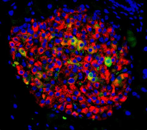 Researchers find new potential approach to ty | EurekAlert!