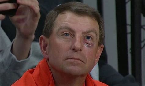 Why Clemson football's Dabo Swinney had black eye at basketball game ...