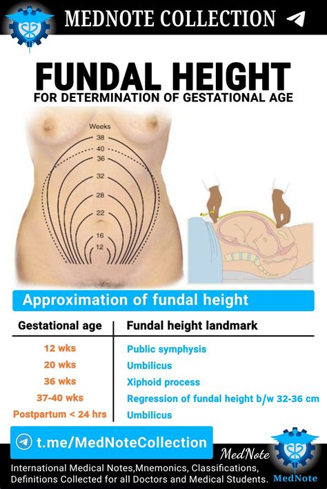 FUNDAL HEIGHT | Medical knowledge, Nursing notes, Gestational age