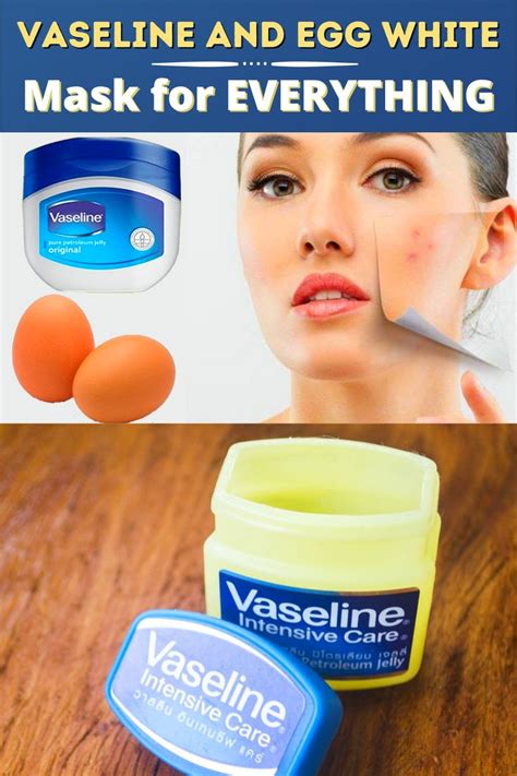 Vaseline and Egg White Mask for EVERYTHING in 2021 | Egg white mask ...