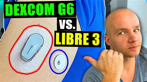 FreeStyle Libre 3 vs Dexcom G6 | Full Test & Review - YouTube