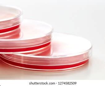 Blood Agar Plates Which Enriched Bacterial Stock Photo 1274582509 | Shutterstock