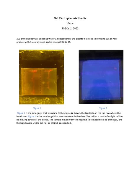 Gel Electrophoresis Result 1 - Gel Electrophoresis Results Name 30 ...