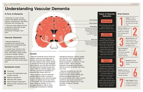 Vascular dementia - Penn Memory Center