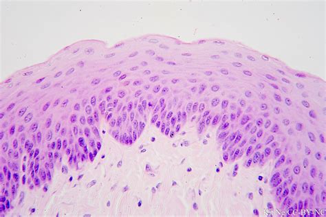 Stratified Squamous Nonkeratinized Epithelium Tongue