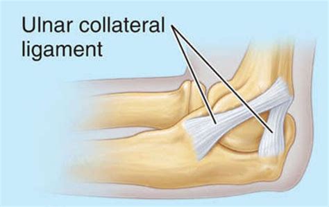 Ulnar Collateral Ligament Rehabilitation