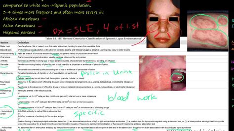 89P Systemic lupus erythematosus, SLE, how to diagnosis, Etiology and ...