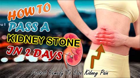 Kidney Stone, The Fastest Treatment Of Kidney Pain, Get Result In 2 Days - YouTube