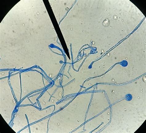 Rhizopus | Biology art, Nursing school survival, School survival