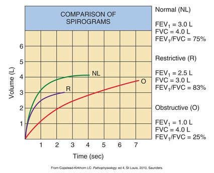 Spirometry Normal Values Chart