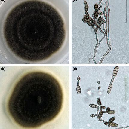 Symptoms of ramie black leaf spot caused by Alternaria alternata. (a)... | Download Scientific ...