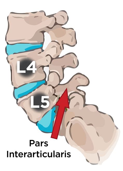 Pin on Back Injuries & Spine Disorders | What's Causing my Back Pain? Lower, Middle, & Upper ...