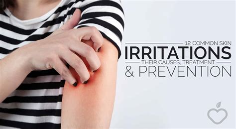 12 Common Skin Irritations: Their Causes, Treatment and Prevention ...