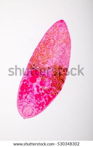 Helminth Parasites Under Microscope View. Stock Photo 530348302 : Shutterstock