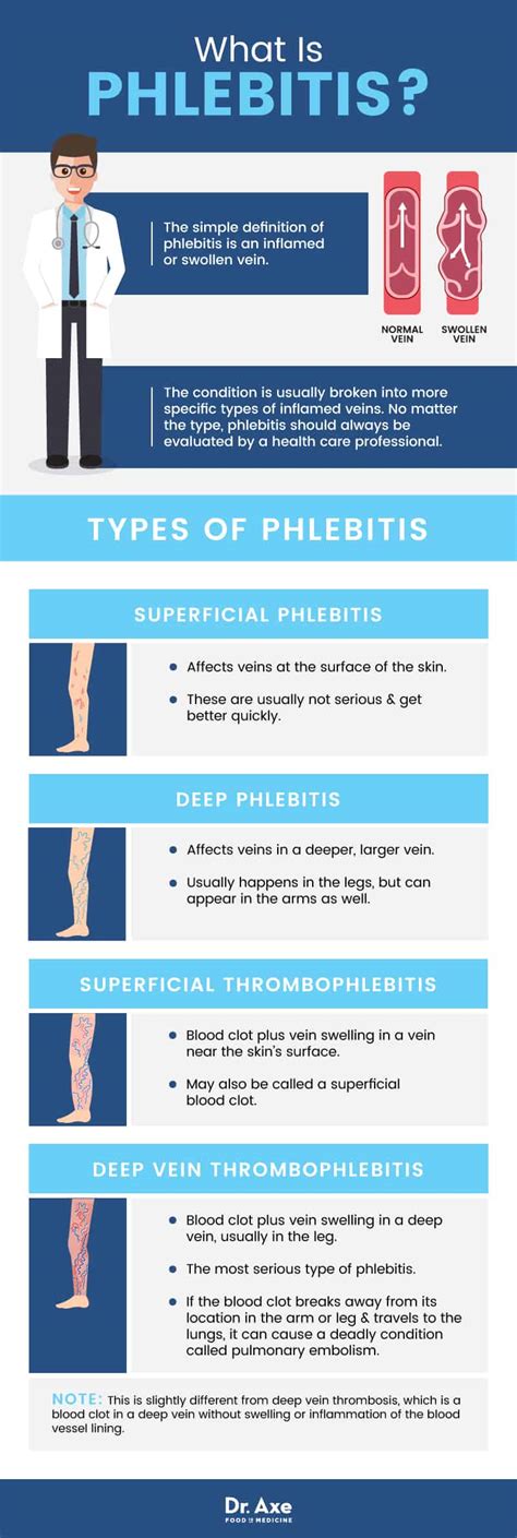 Phlebitis (5 Natural Ways to Improve Symptoms) - Dr. Axe