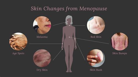 Itchy skin? Are you "Menopause"ing?