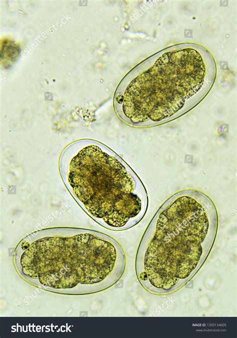 Eggs Hookworm Stool Analyze By Microscope Stock Photo 1350134609 | Shutterstock