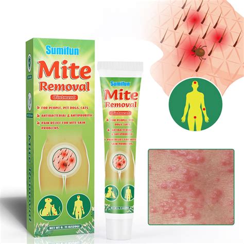 Buy FLW 20g Mite Removal Cream Non-Pungent Anti-Itch External Use Scabies Pubic Lice Ointment ...