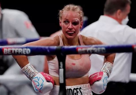 Battered Ebanie Bridges left disfigured with ugly eye injury from her bloody boxing bout - Daily ...