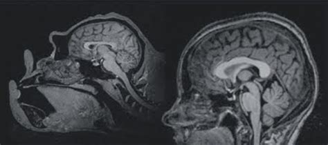 eScienceCommons: Inside the chimpanzee brain