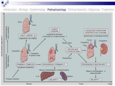 Pathogenesis of tuberculosis