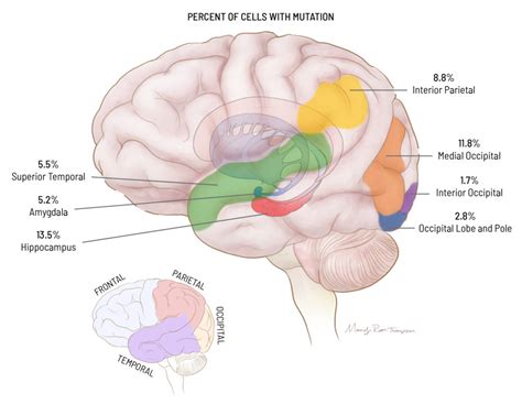 Epilepsy Brain Diagram