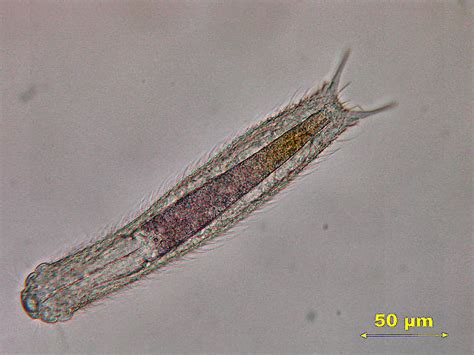 Index of /animalcules/gastrotricha