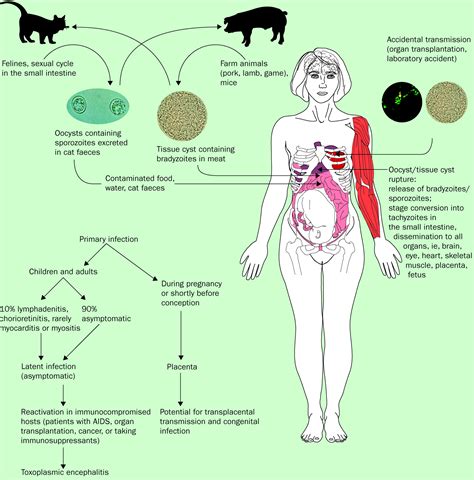 Toxoplasmosis Symptoms Pregnancy