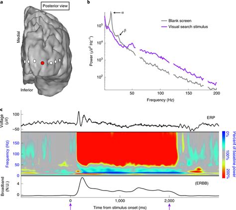 An example of basic ECoG changes when a cortical area becomes... | Download Scientific Diagram