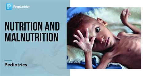 Nutrition And Malnutrition