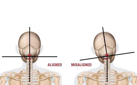 #96 How Does A NUCCA Adjustment Work? - Gardner Schofield Chiropractic