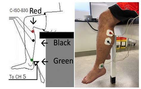 Assessment of Patellar and Achilles Reflexes – A Mixed Course-Based ...