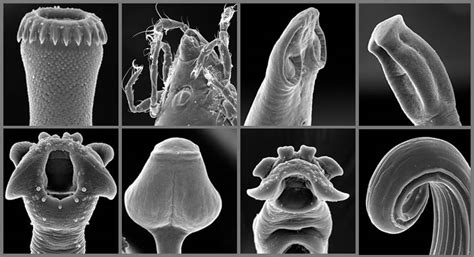 Tapeworm Under A Microscope