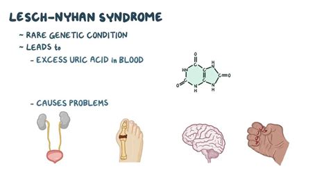 Lesch-Nyhan syndrome: Video, Anatomy & Definition | Osmosis